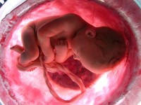 Jovens darão fim ao aborto no futuro, dizem especialistas; Tendência de valorização da vida vem sendo observada por pesquisadores