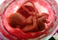 Contra o aborto, Silas Malafaia compara prática a assassinato: “A vida humana começa na concepção”; Leia na íntegra