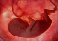 Pastor encontra feto em banheiro da Igreja Mundial; Polícia tentará identificar a autora do aborto