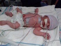 Milagre: bebê com expectativa de vida de cinco minutos surpreende médicos e mobiliza orações por recuperação completa