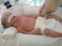 Bebê recém-nascida é declarada morta e volta a respirar 28 minutos depois; “Milagre”, dizem médicos