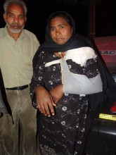Aysha com o braço quebrado após espancamento