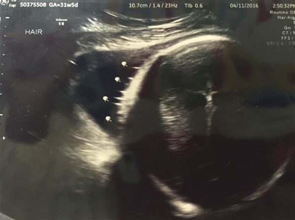 Imagem completa do ultrassom
