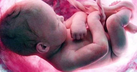 Aborto até o momento do nascimento