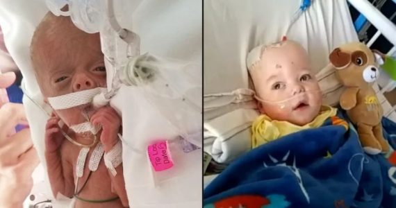 Bebê declarado morto por médicos volta à vida e se recupera; ‘Foi milagre’, disse a mãe
