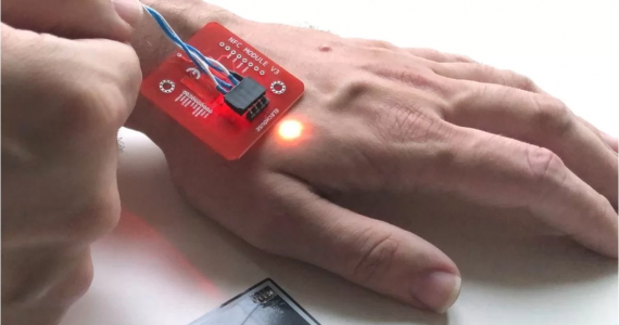 Implante de microchip para o pagamento de compras já é uma realidade