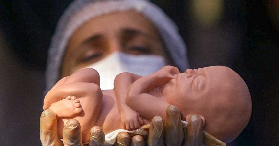 MP reconhece que o aborto é tortura para o bebê e pede anestesia