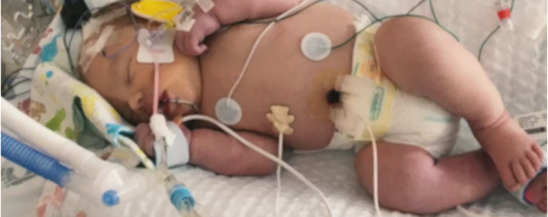 Desenganado pela medicina, bebê sobrevive a parto complicado e pais falam em milagre