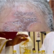 Católicos apresentam queimadura na testa após unção com óleo durante missa